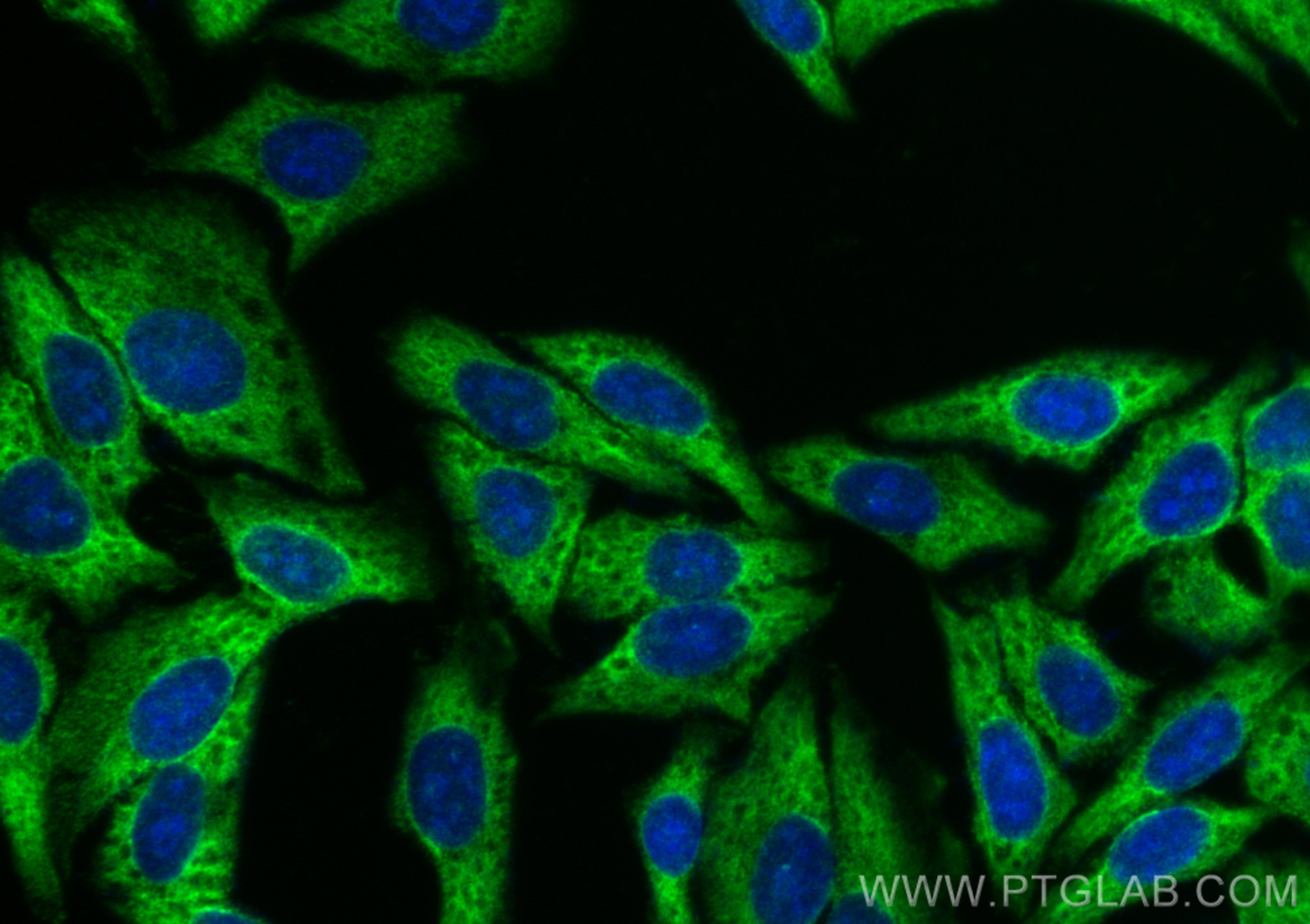 Immunofluorescence (IF) / fluorescent staining of HepG2 cells using DDX3 Recombinant antibody (81903-1-RR)