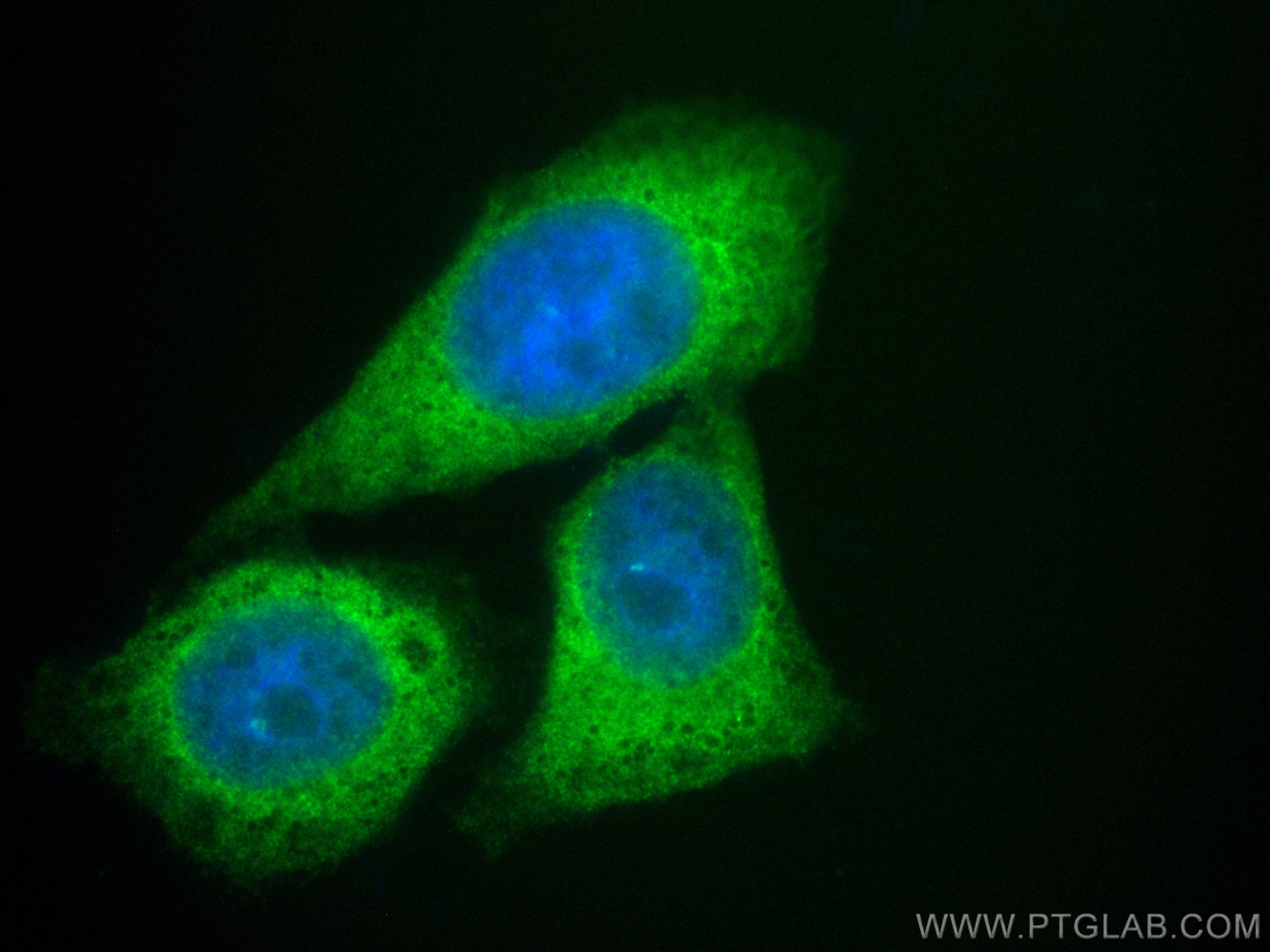 Immunofluorescence (IF) / fluorescent staining of HepG2 cells using CoraLite® Plus 488-conjugated DDX3 Polyclonal anti (CL488-11115)