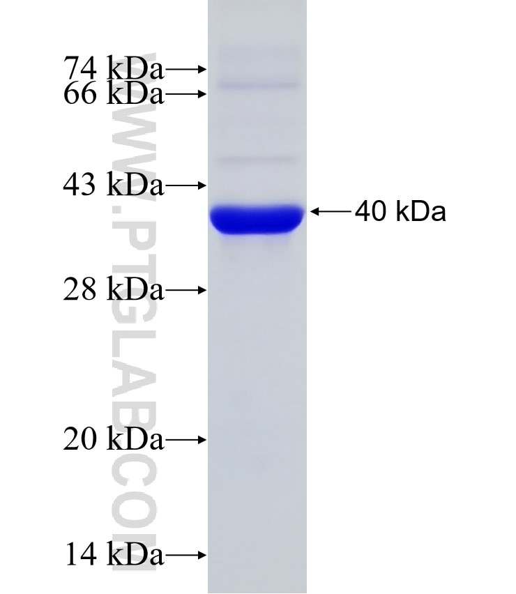 DDX3 fusion protein Ag29972 SDS-PAGE