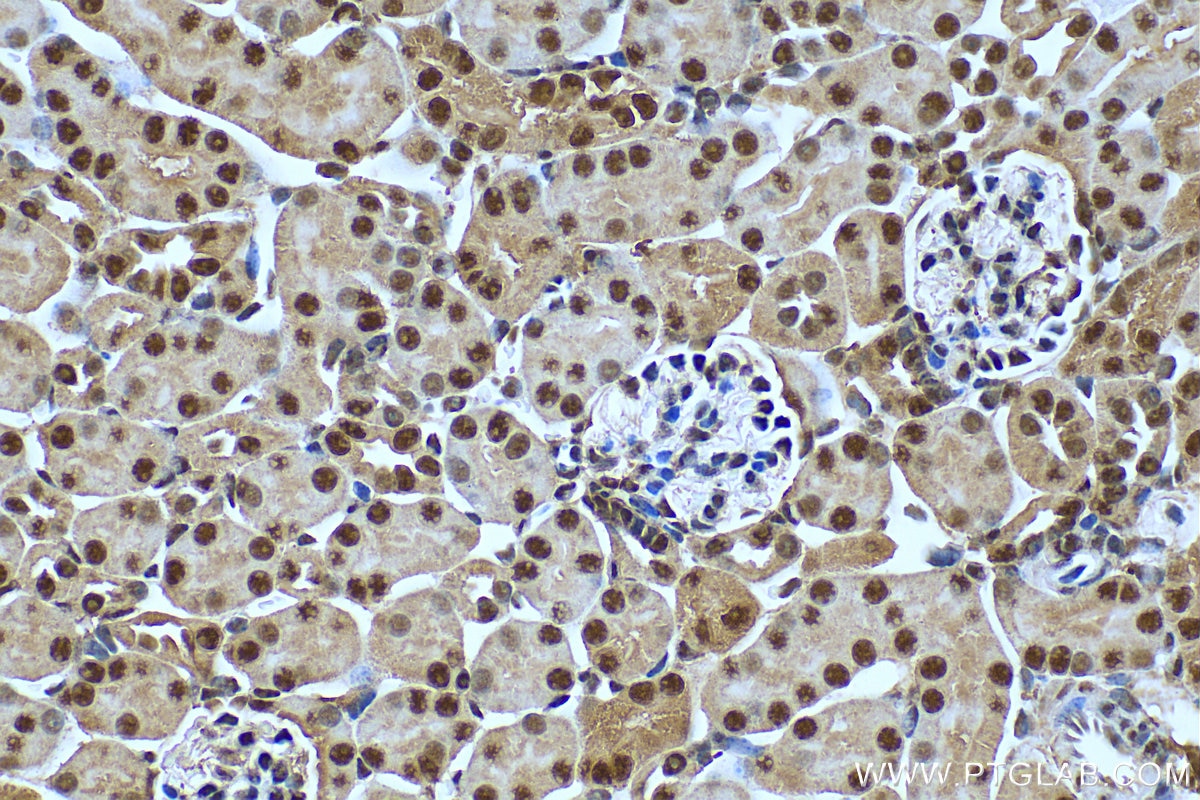 Immunohistochemistry (IHC) staining of mouse kidney tissue using DDX39A Polyclonal antibody (11723-1-AP)