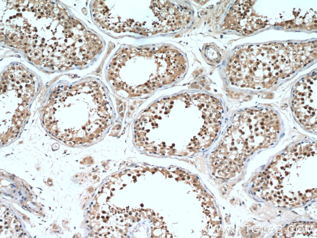 Immunohistochemistry (IHC) staining of human testis tissue using DDX39A Polyclonal antibody (11723-1-AP)