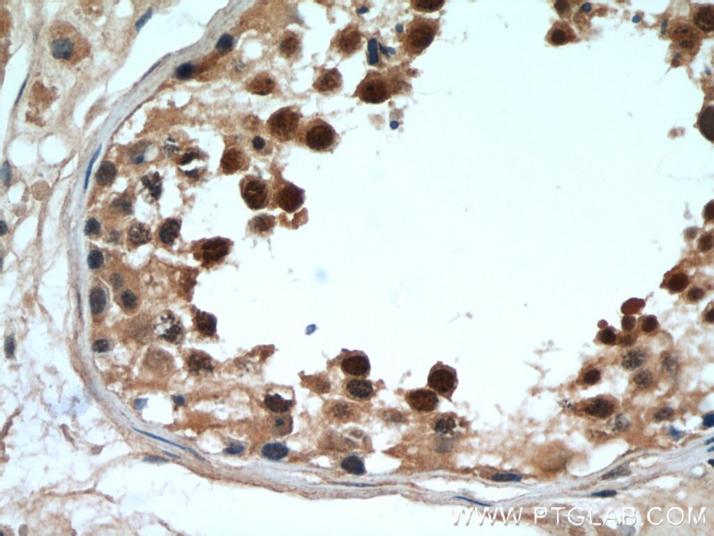 Immunohistochemistry (IHC) staining of human testis tissue using DDX39A Polyclonal antibody (11723-1-AP)