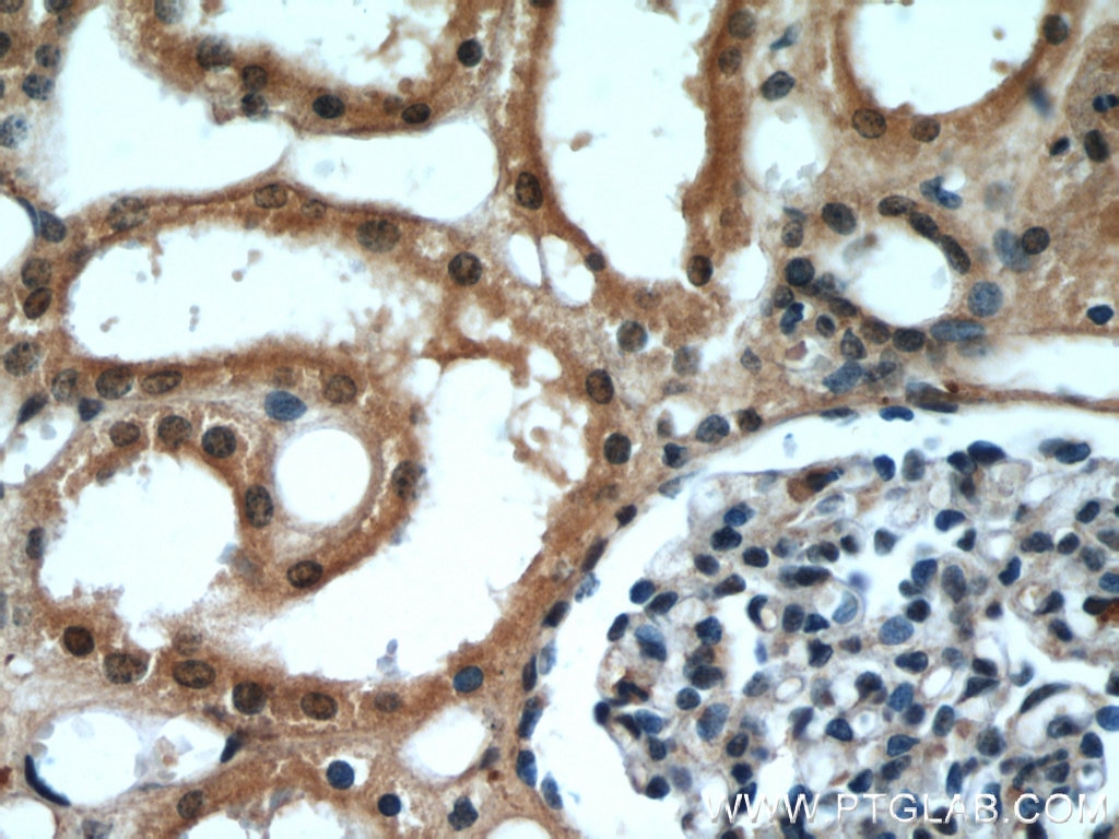 Immunohistochemistry (IHC) staining of human kidney tissue using DDX39A Polyclonal antibody (11723-1-AP)