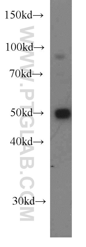 Western Blot (WB) analysis of A431 cells using DDX39A Polyclonal antibody (11723-1-AP)