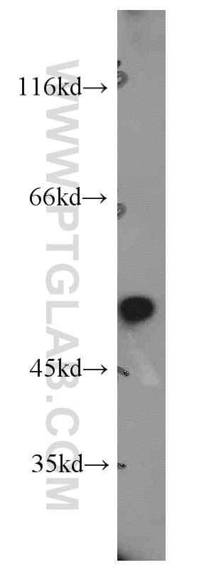 Western Blot (WB) analysis of Raji cells using DDX39A Polyclonal antibody (11723-1-AP)