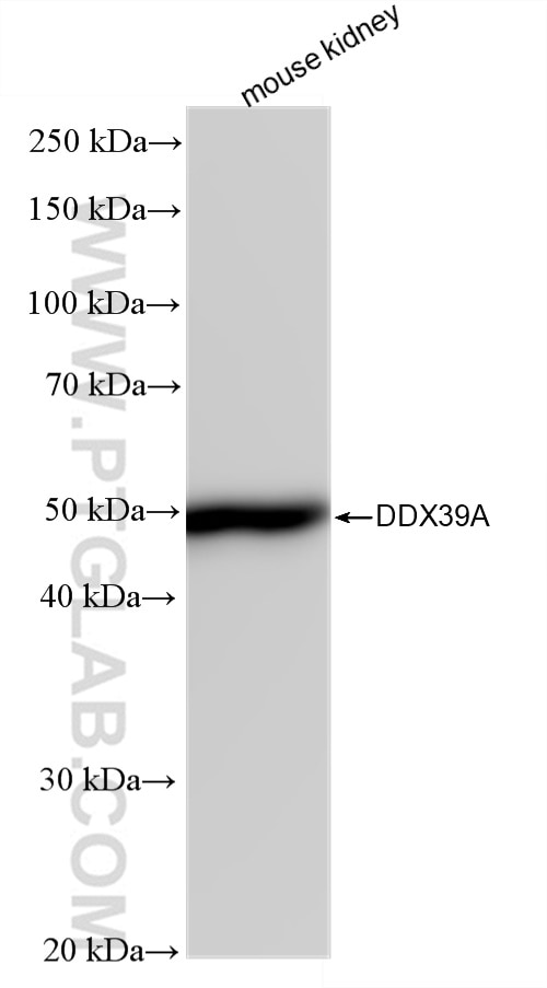 Western Blot (WB) analysis of various lysates using DDX39A Recombinant antibody (83083-5-RR)
