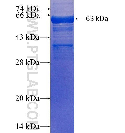 DDX39 fusion protein Ag2311 SDS-PAGE