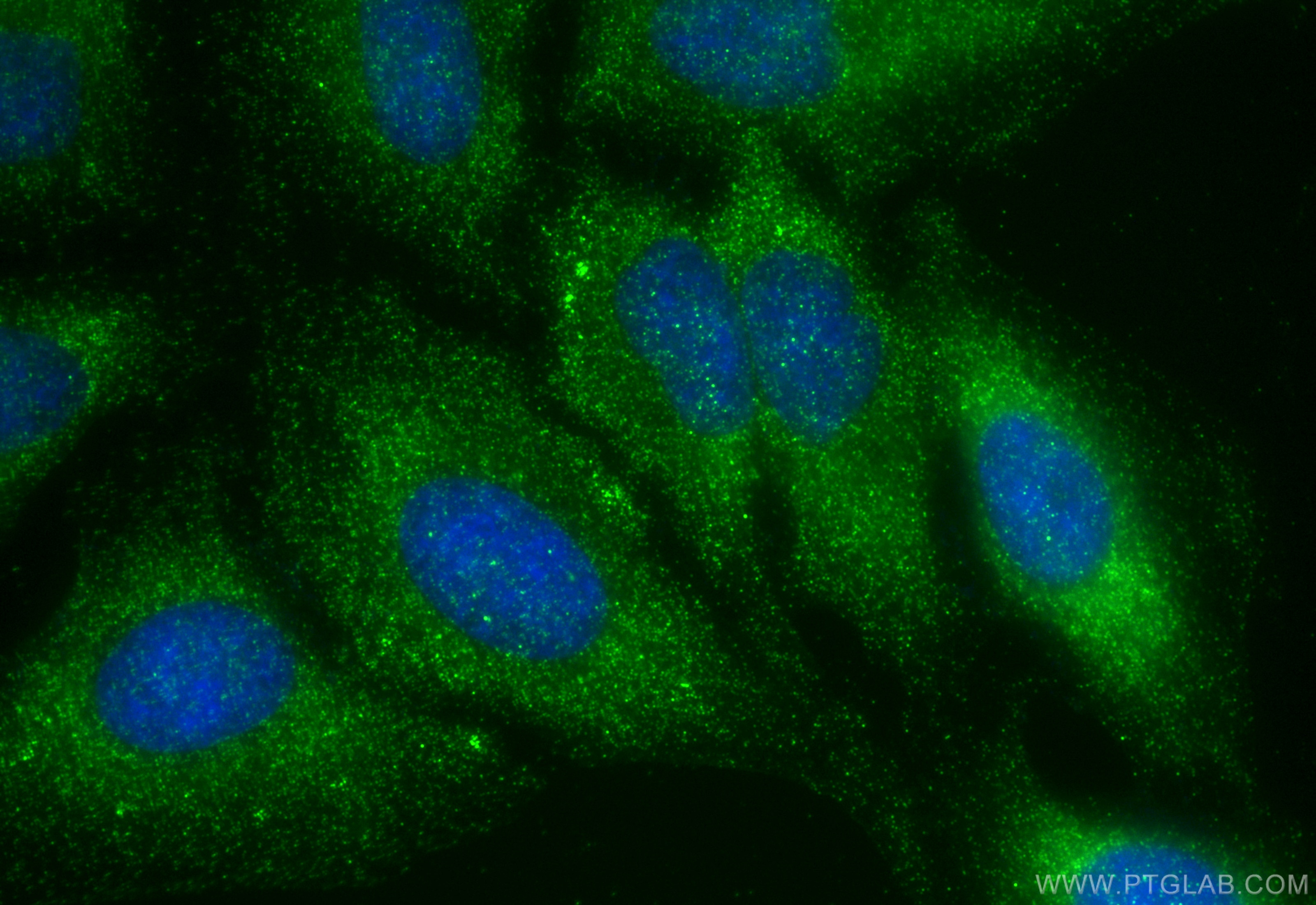 Immunofluorescence (IF) / fluorescent staining of HeLa cells using DDX3Y Polyclonal antibody (14041-1-AP)