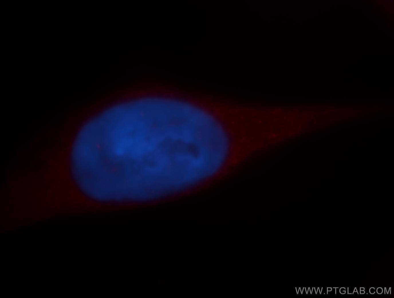 Immunofluorescence (IF) / fluorescent staining of HeLa cells using DDX3Y Polyclonal antibody (14041-1-AP)