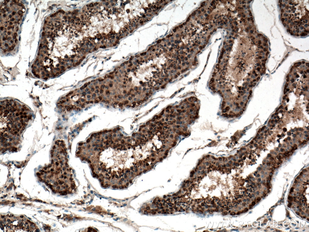 Immunohistochemistry (IHC) staining of human testis tissue using DDX3Y Polyclonal antibody (14041-1-AP)