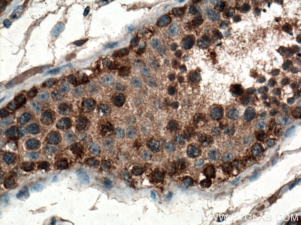 Immunohistochemistry (IHC) staining of human testis tissue using DDX3Y Polyclonal antibody (14041-1-AP)