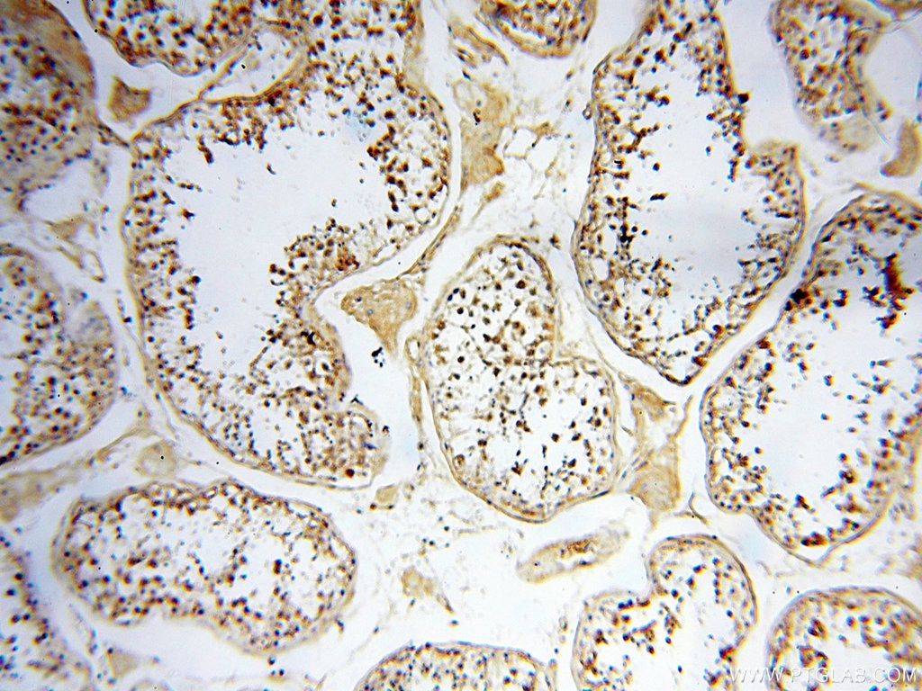 Immunohistochemistry (IHC) staining of human testis tissue using DDX3Y Polyclonal antibody (14041-1-AP)