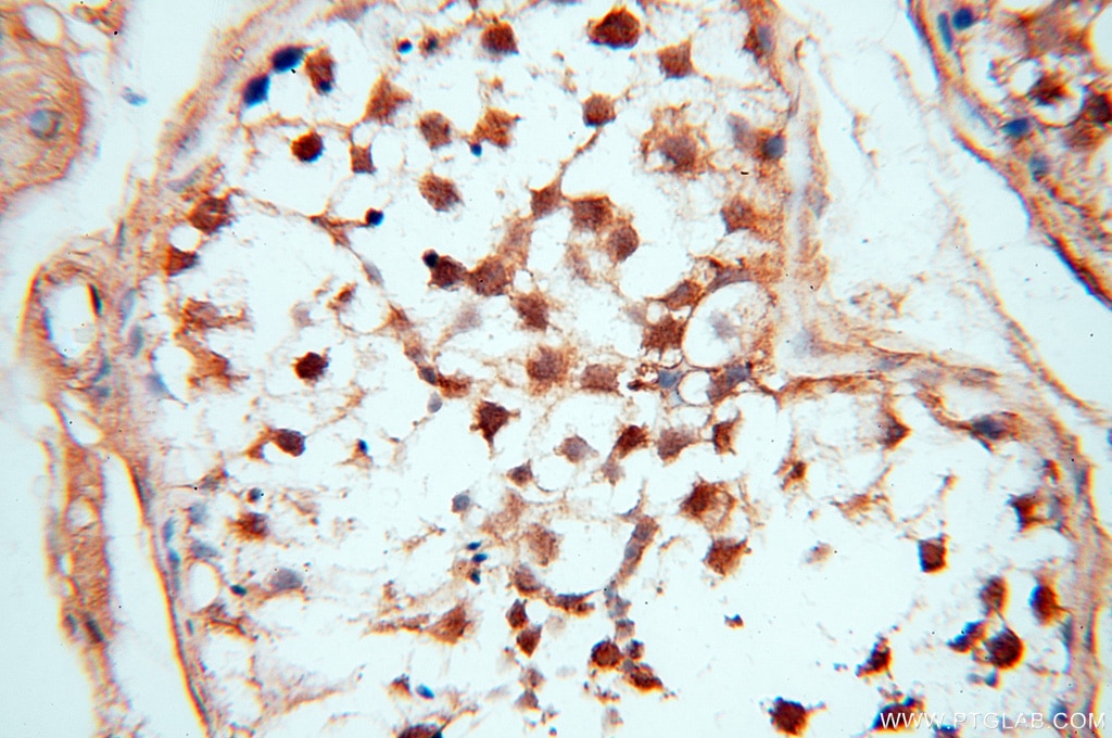 IHC staining of human testis using 14041-1-AP