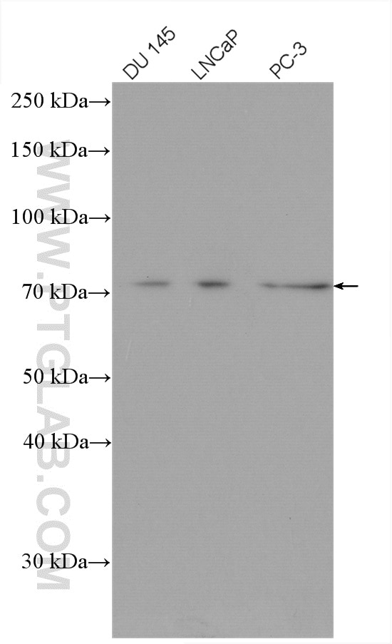 Western Blot (WB) analysis of various lysates using DDX3Y Polyclonal antibody (14041-1-AP)