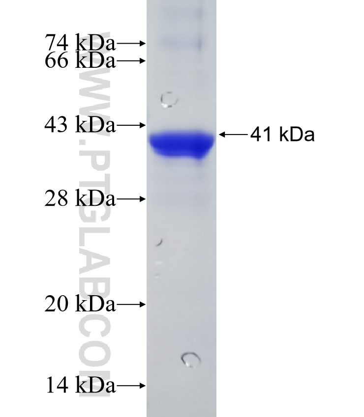 DDX3Y fusion protein Ag31231 SDS-PAGE DDX3Y fusion protein Ag31231 SDS-PAGE