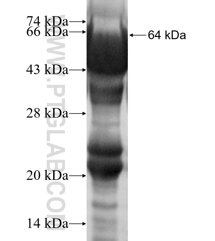 DDX3Y fusion protein Ag5110 SDS-PAGE