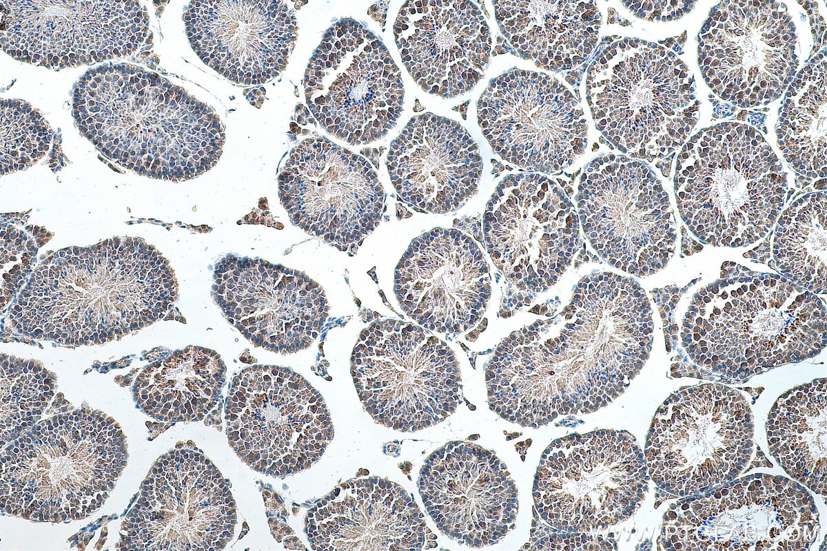 IHC staining of mouse testis using 12888-1-AP