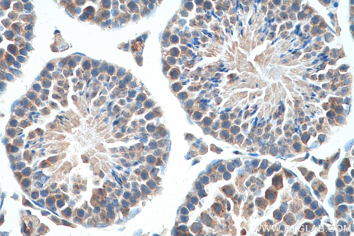 Immunohistochemistry (IHC) staining of mouse testis tissue using DDX4/VASA Polyclonal antibody (12888-1-AP)