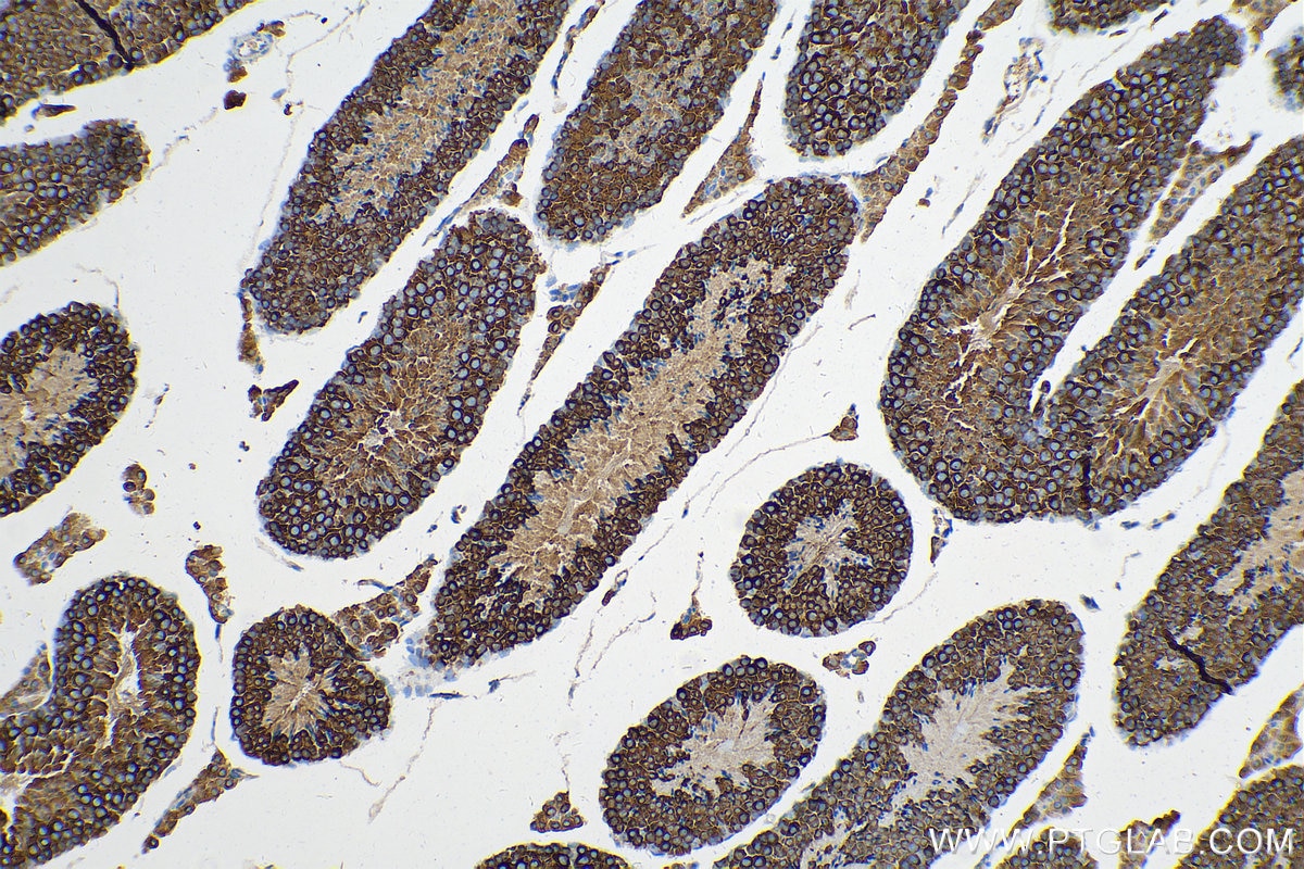 Immunohistochemistry (IHC) staining of mouse testis tissue using DDX4,VASA Polyclonal antibody (17545-1-AP)