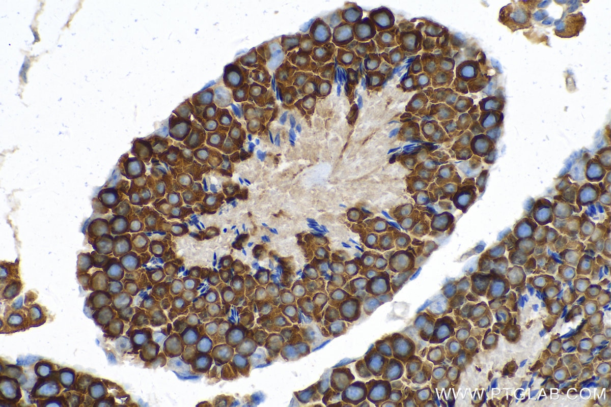 IHC staining of mouse testis using 17545-1-AP