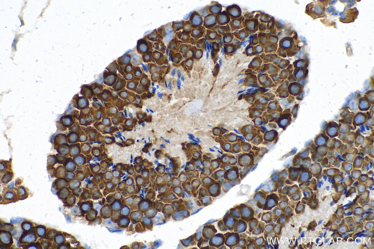 Immunohistochemistry (IHC) staining of mouse testis tissue using DDX4,VASA Polyclonal antibody (17545-1-AP)