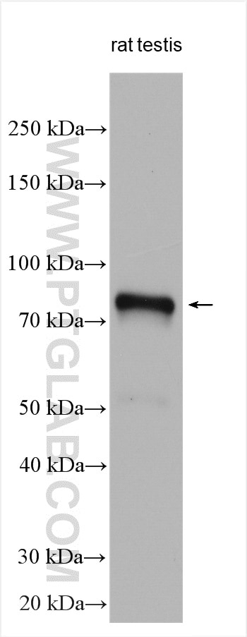 Western Blot (WB) analysis of rat testis tissue using DDX4,VASA Polyclonal antibody (17545-1-AP)