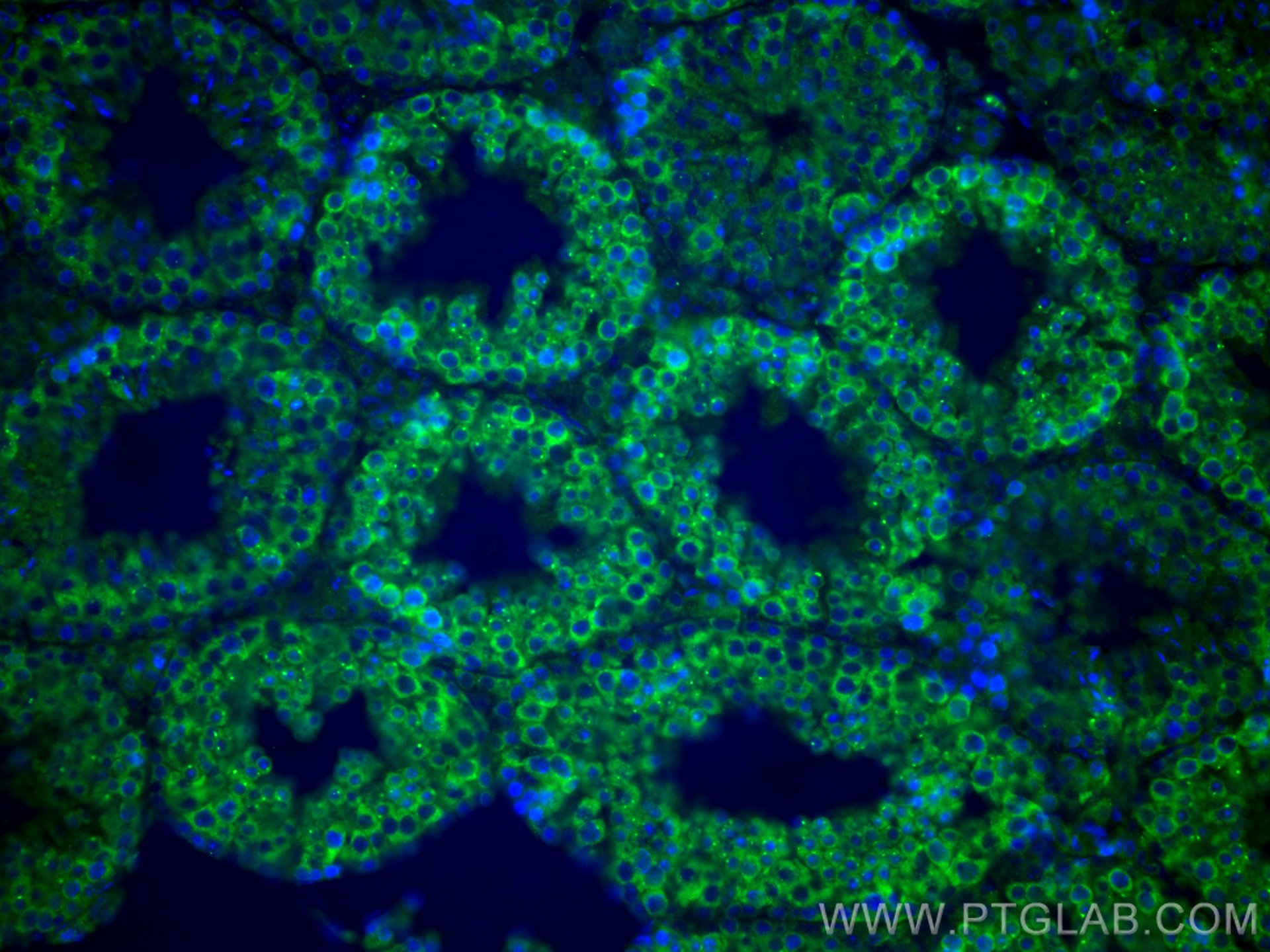 Immunofluorescence (IF) / fluorescent staining of mouse testis tissue using DDX4,VASA Polyclonal antibody (51042-1-AP)