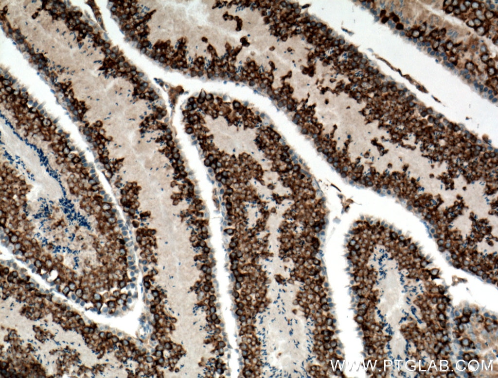 Immunohistochemistry (IHC) staining of mouse testis tissue using DDX4,VASA Polyclonal antibody (51042-1-AP)