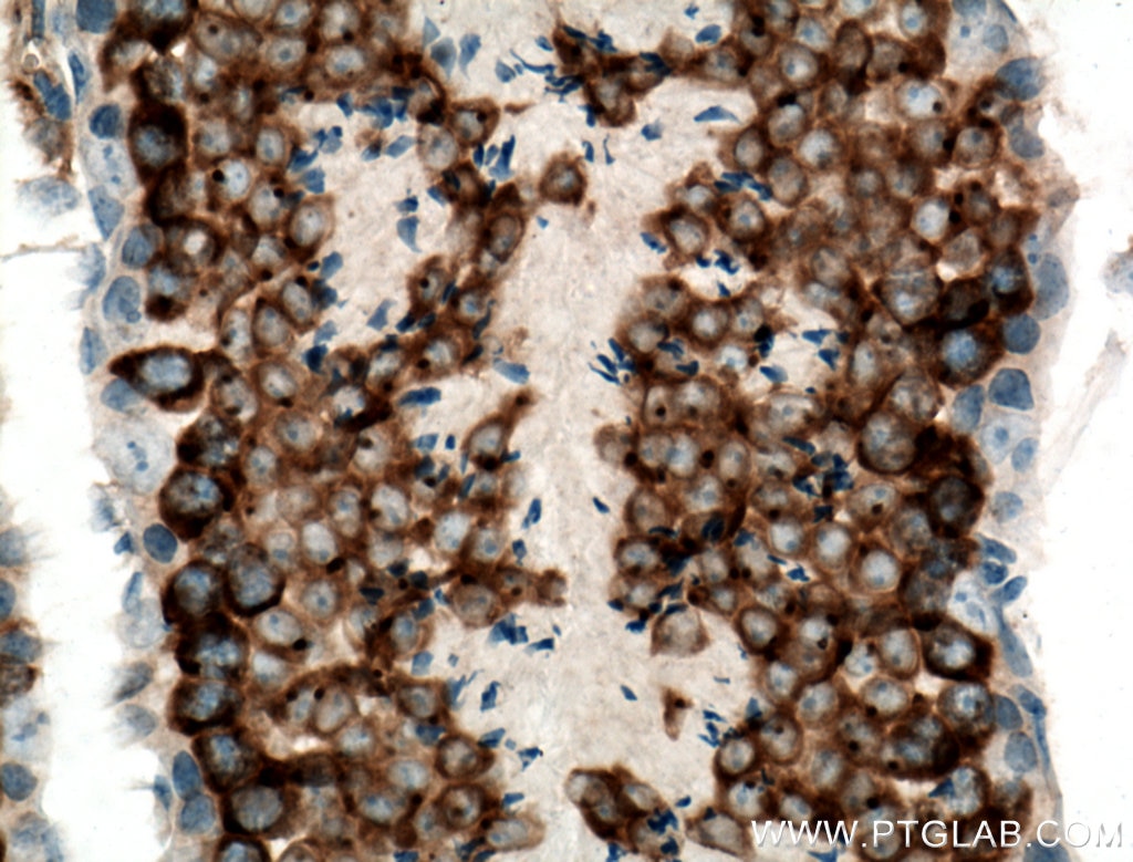 Immunohistochemistry (IHC) staining of mouse testis tissue using DDX4,VASA Polyclonal antibody (51042-1-AP)