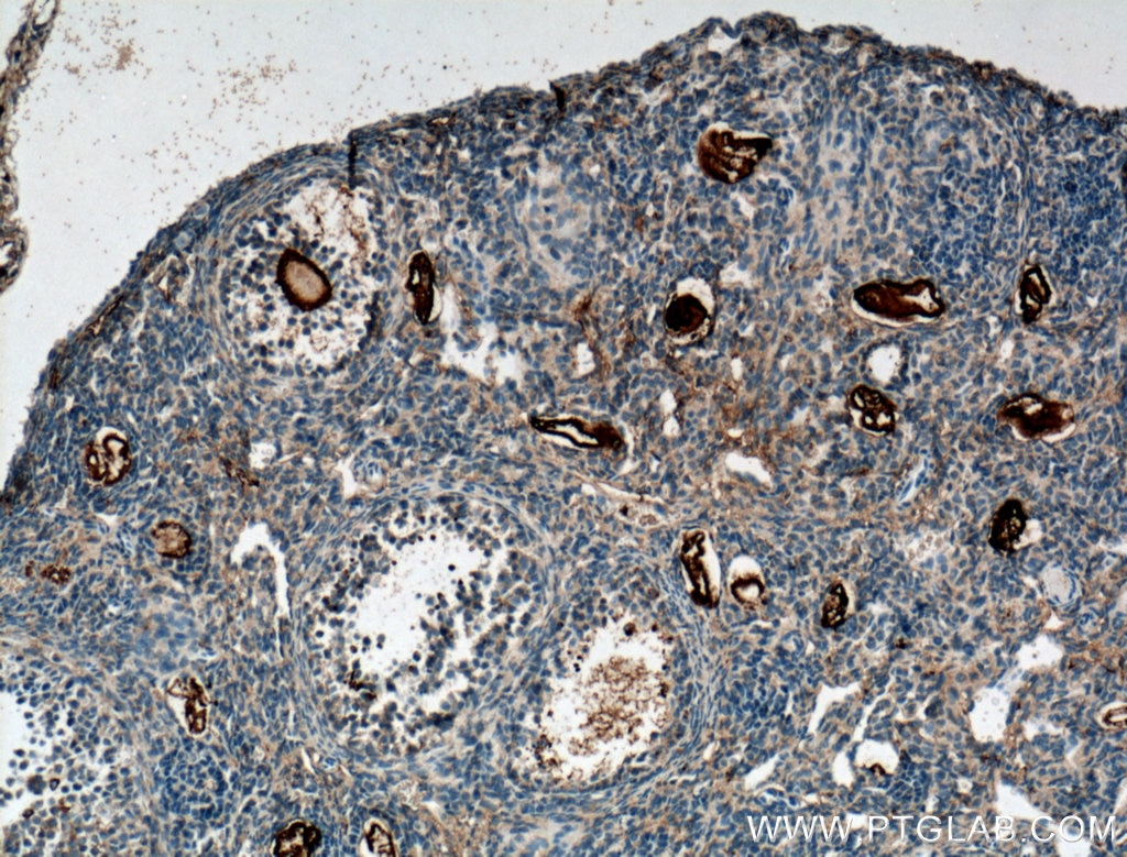 IHC staining of mouse ovary using 51042-1-AP