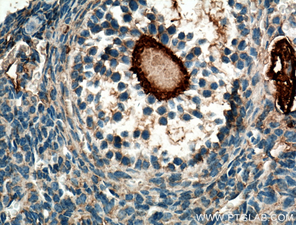 Immunohistochemistry (IHC) staining of mouse ovary tissue using DDX4,VASA Polyclonal antibody (51042-1-AP)