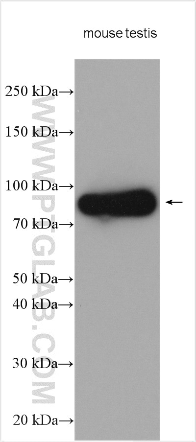 Western Blot (WB) analysis of various lysates using DDX4,VASA Polyclonal antibody (51042-1-AP)