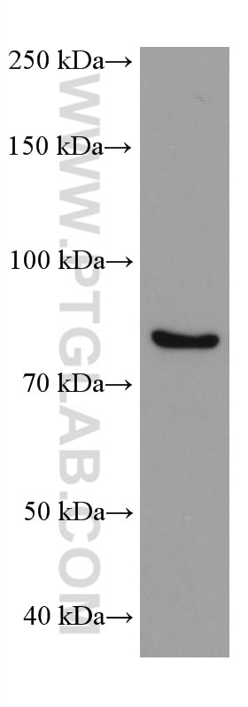 Western Blot (WB) analysis of SKOV-3 cells using DDX4,VASA Monoclonal antibody (67147-2-Ig)
