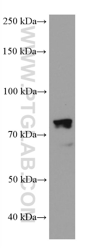 Western Blot (WB) analysis of NCCIT cells using DDX4,VASA Monoclonal antibody (67147-2-Ig)