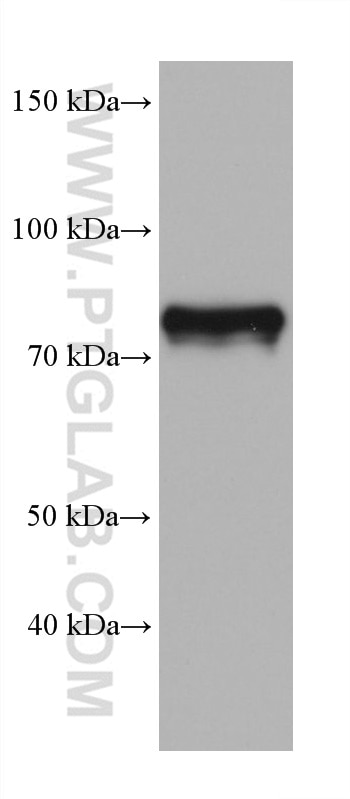 Western Blot (WB) analysis of rat testis tissue using DDX4,VASA Monoclonal antibody (67147-2-Ig)