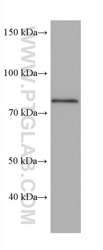 WB analysis of JAR using 67147-2-Ig