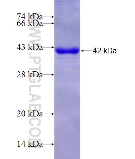 DDX4,VASA fusion protein Ag11630 SDS-PAGE
