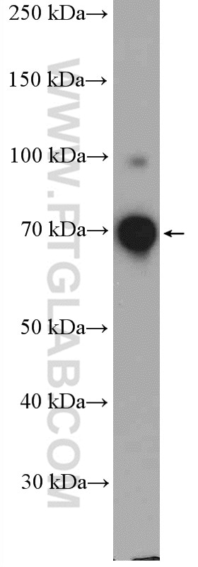 Western Blot (WB) analysis of MCF-7 cells using DDX41 Polyclonal antibody (27500-1-AP)