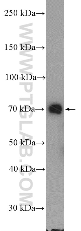Western Blot (WB) analysis of MCF-7 cells using DDX41 Polyclonal antibody (27500-1-AP)