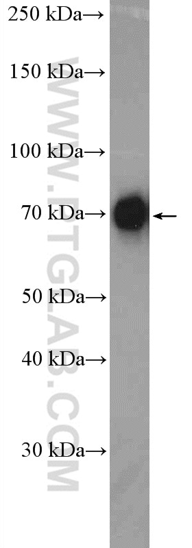 Western Blot (WB) analysis of RAW 264.7 cells using DDX41 Polyclonal antibody (27500-1-AP)