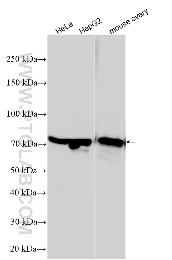 Western Blot (WB) analysis of various lysates using DDX41 Polyclonal antibody (27500-1-AP)