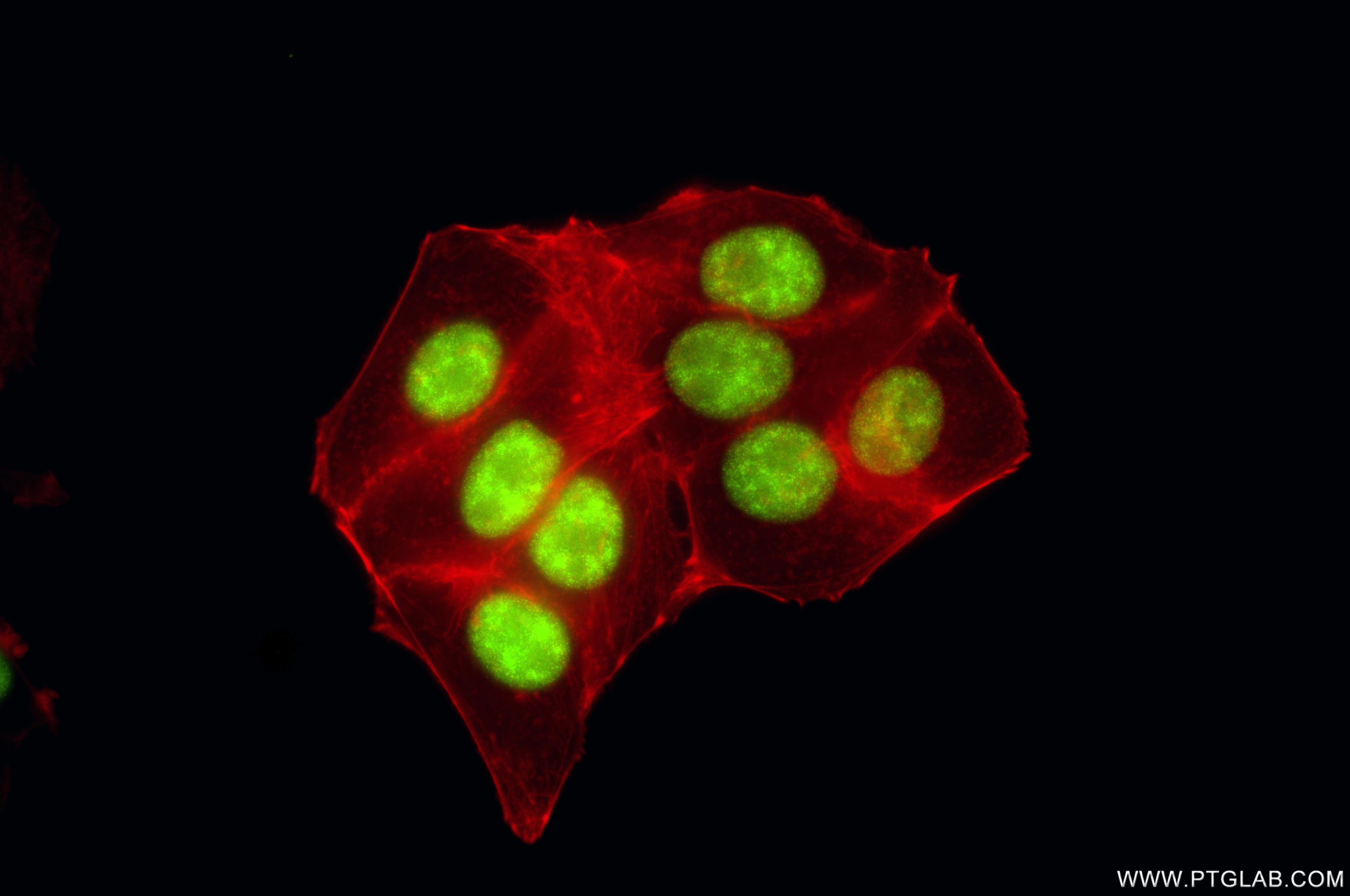 Immunofluorescence (IF) / fluorescent staining of MCF-7 cells using DDX41 Recombinant monoclonal antibody (86894-1-RR)