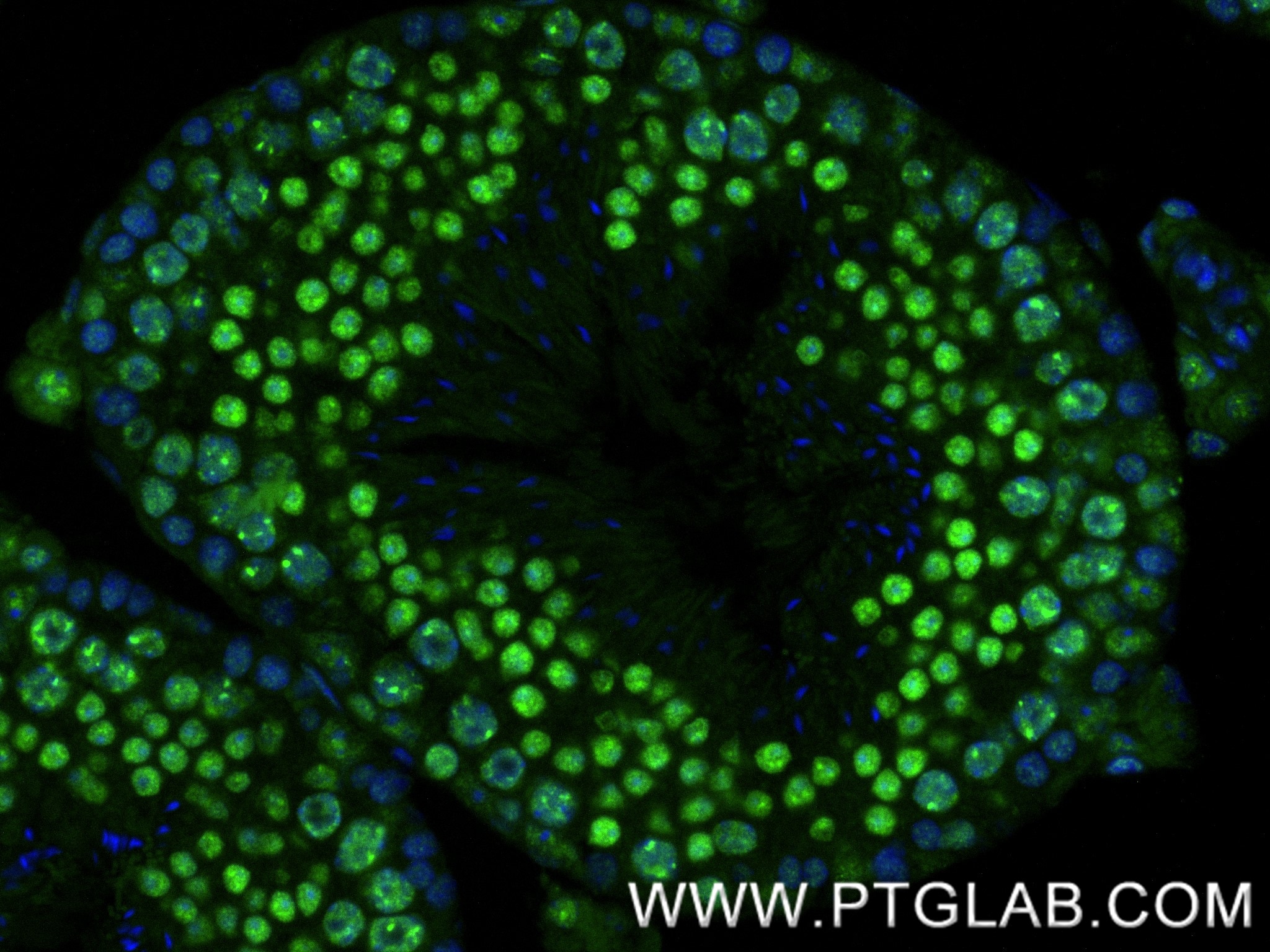Immunofluorescence (IF) / fluorescent staining of mouse testis tissue using DDX41 Recombinant monoclonal antibody (86894-1-RR)