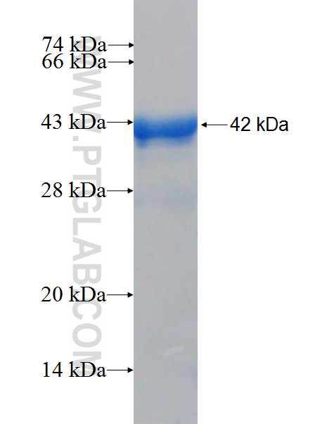 DDX41 fusion protein Ag26593 SDS-PAGE