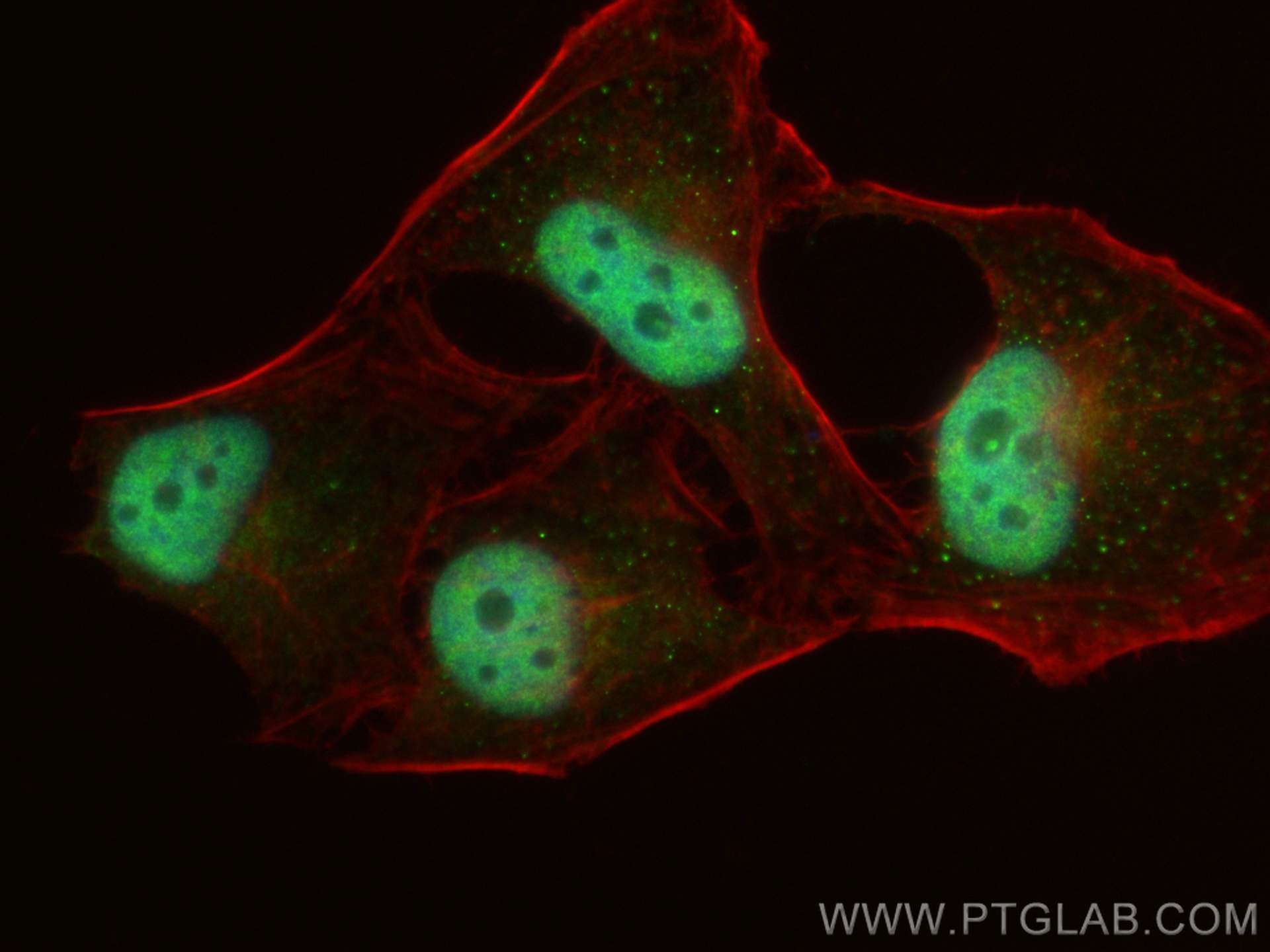 Immunofluorescence (IF) / fluorescent staining of HeLa cells using DDX42 Polyclonal antibody (31211-1-AP)