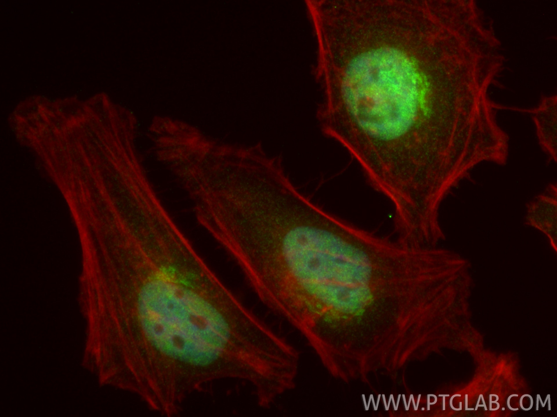 IF Staining of HeLa using 31211-1-AP (same clone as 31211-1-PBS) Immunofluorescence (IF) / fluorescent staining of HeLa cells using DDX42 Polyclonal antibody (31211-1-AP)