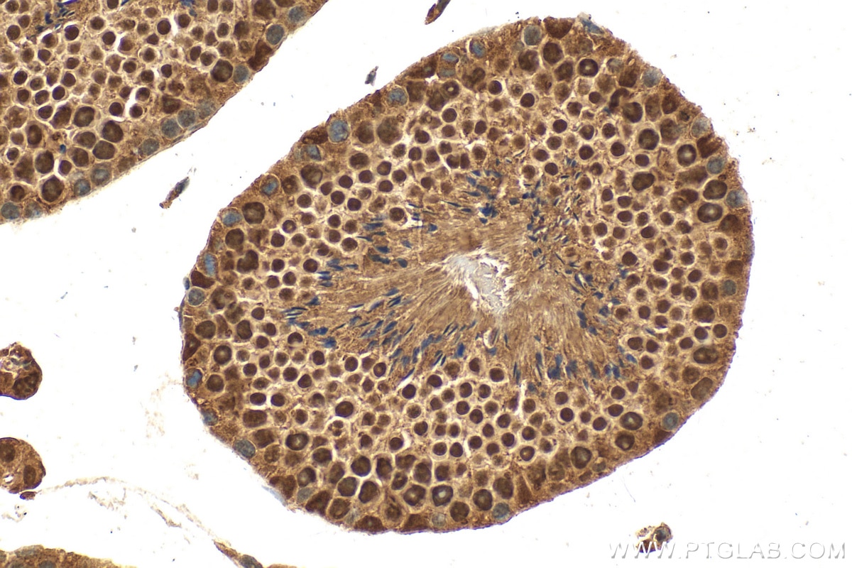 Immunohistochemistry (IHC) staining of mouse testis tissue using DDX42 Polyclonal antibody (31211-1-AP)
