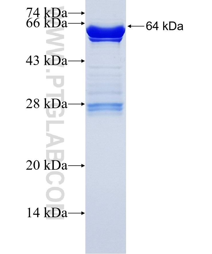 DDX42 fusion protein Ag34762 SDS-PAGE