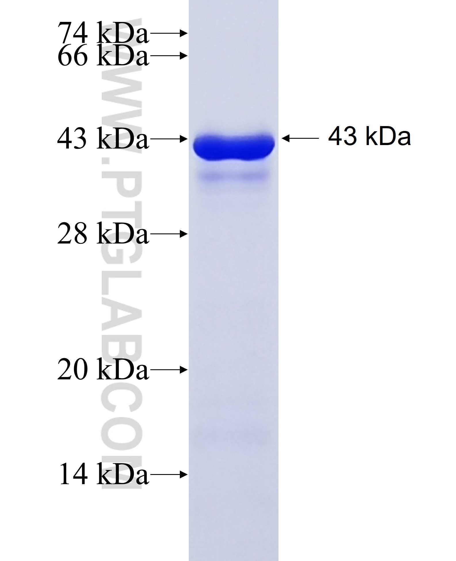 DDX42 fusion protein Ag34786 SDS-PAGE DDX42 fusion protein Ag34786 SDS-PAGE