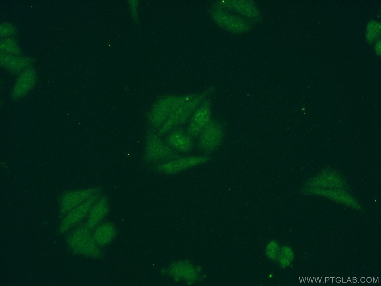 Immunofluorescence (IF) / fluorescent staining of HepG2 cells using DDX43 Polyclonal antibody (17591-1-AP)